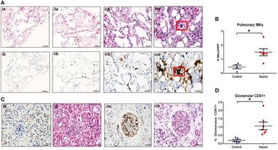 Megakaryocytes respond during sepsis and display innate immune cell behaviors